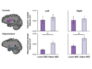 Bar graphs comparing hippocampal volume by socioeconomic status